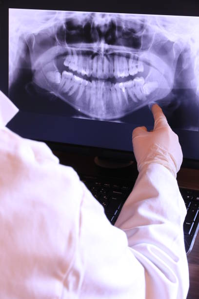 Best Knocked-Out Tooth (Avulsed Tooth) Treatment in Buckeye, AZ